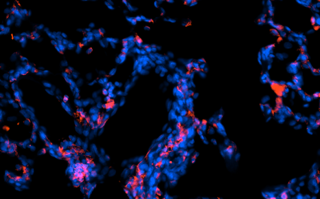 Guinea Pig Interleukin 17 Polyclonal Antibody
